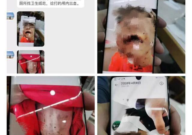 警方通報黑龍江女童被虐打1.jpg