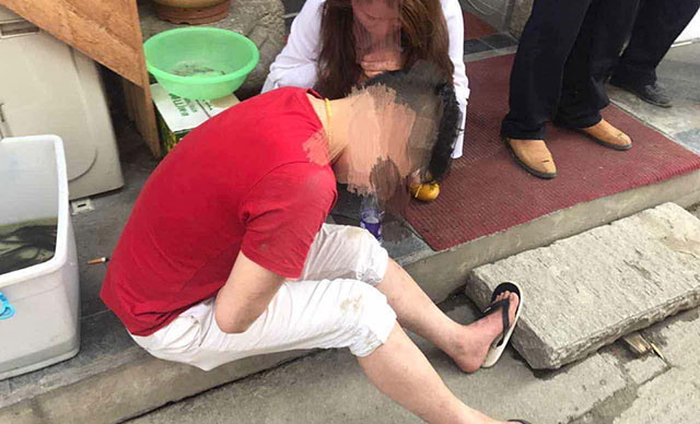 把普通人當(dāng)搶劫犯打了需要承擔(dān)什么法律責(zé)任？